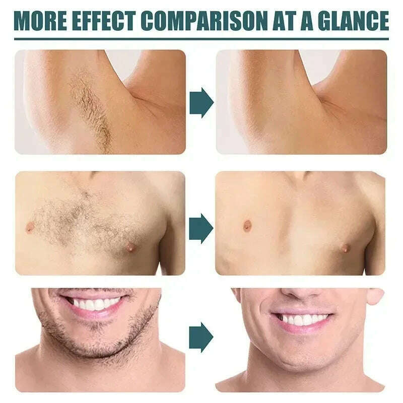 Men Hair Remover Cream Inhibition Hair Growth Eliminate Beard Armpit Chest Private Parts Gently Depilatory Painless Remover
