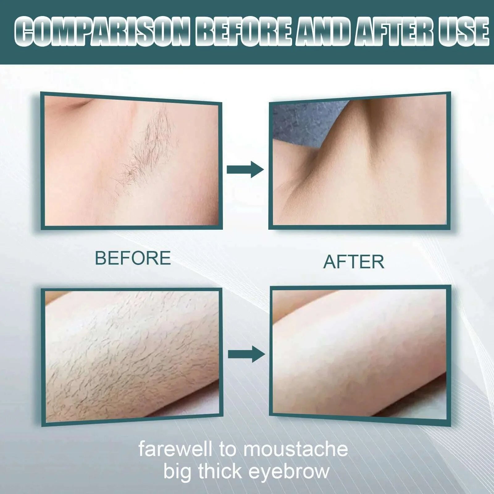 Men Hair Remover Cream Inhibition Hair Growth Eliminate Beard Armpit Chest Private Parts Gently Depilatory Painless Remover