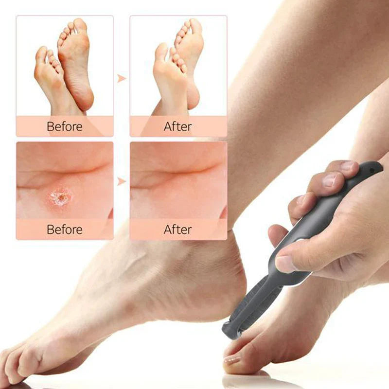 Rechargeable Callus Remover Tool Home Foot Spa Bath Massager Pedicure Experience Removes Dry Skin for Smoother Feet