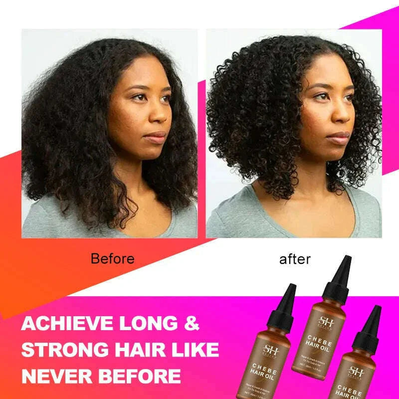 Sevich 30ml Africa Traction Alopecia Chebe Hair Oil Crazy Thicken Fast Hair Growing Oil Anti-Hair Loss Wildly Grow Long Hair