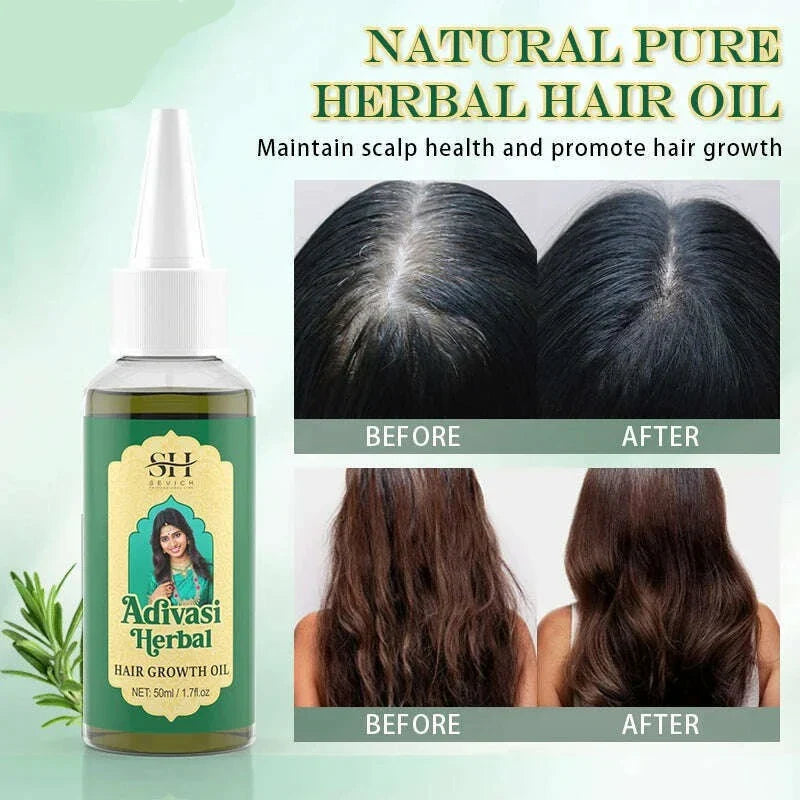 Ayurvedic Hair Growth Oil India Adivasi Herbal Hair Oil Rosemary Anti Hair Loss Fast Regrowth Thicken Oils Hair Growth Products