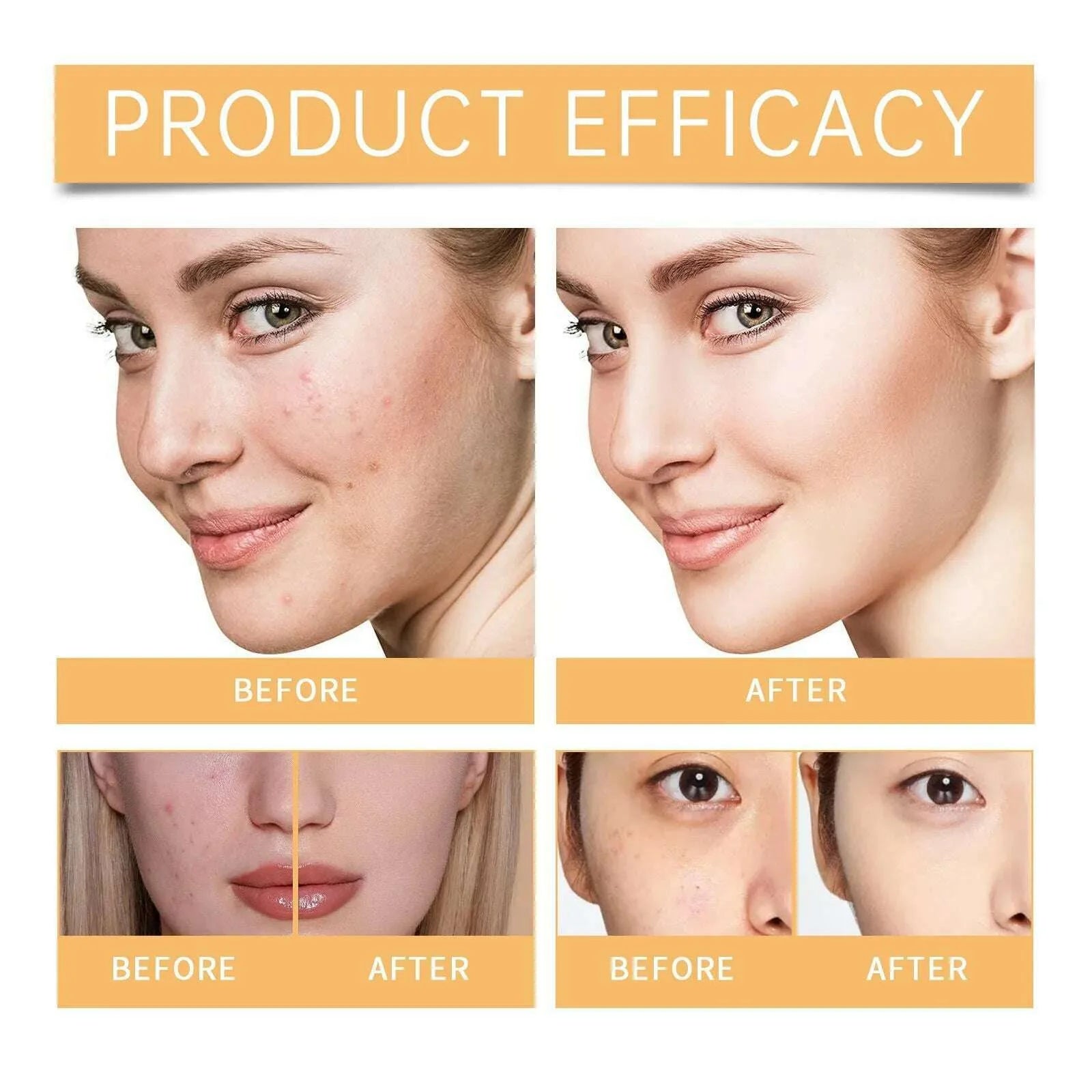 Glycolic 7% Toner 100ML Ordinary Glycolic 7% Toner Remove Acne, Acne Marks, Removing Acne, Repairing And Rejuvenating Skin 100ml