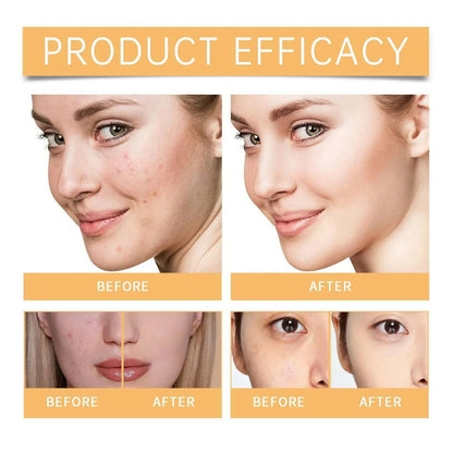 Glycolic 7% Toner 100ML Ordinary Glycolic 7% Toner Remove Acne, Acne Marks, Removing Acne, Repairing And Rejuvenating Skin 100ml